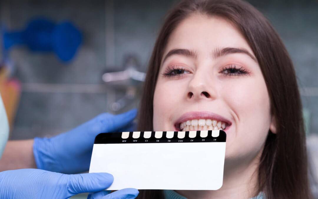 How Your Lexington Dentist Whitens Your Smile